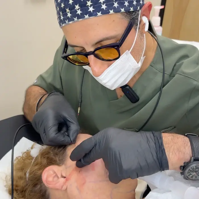 Dr. Ali Abbasi performing Endolift treatment on a patient's face